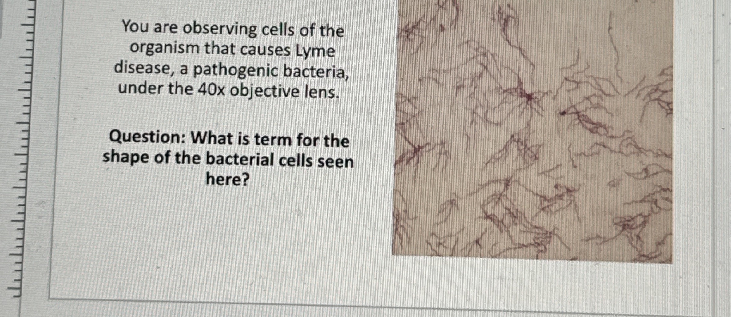 Solved You are observing cells of the organism that causes | Chegg.com