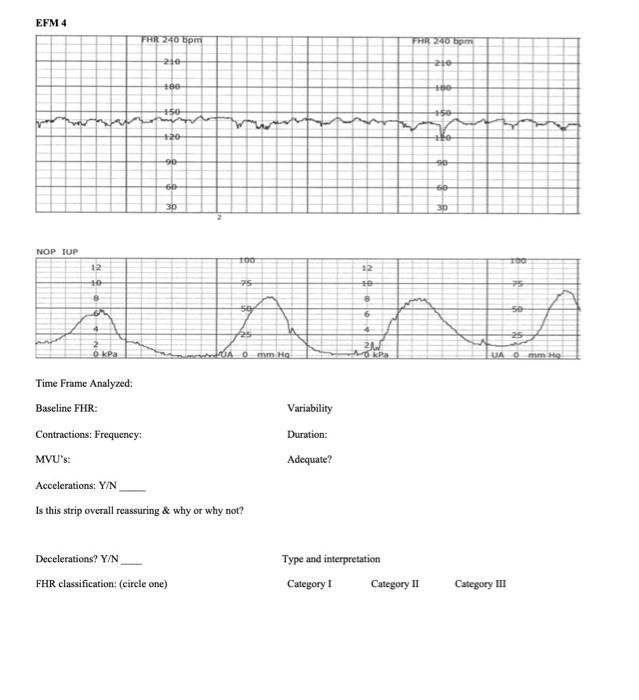 EFM 4 FHR 240 pm FRR 240 bpm 210 zio +60 -50- 50 50 जी 30 30 HOP TUỆ TOO TOO 12 10 50 25 21 O kPa 0mm. He SAOmm Hg Time Frame