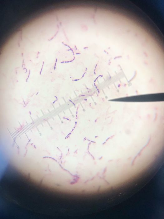 bacillus megaterium gram stain positive