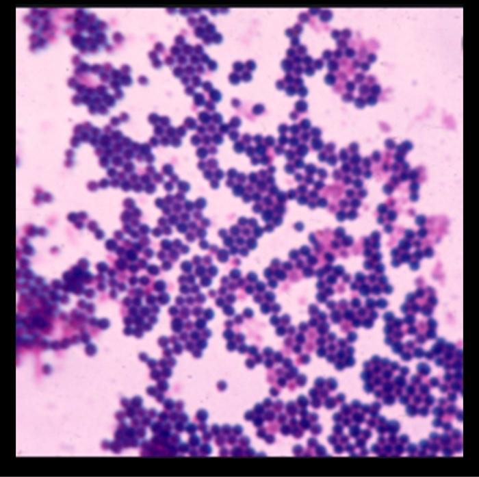 Solved based on this photo, is this specimen gram positive | Chegg.com