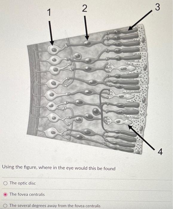 Solved Using the figure, where in the eye would this be | Chegg.com