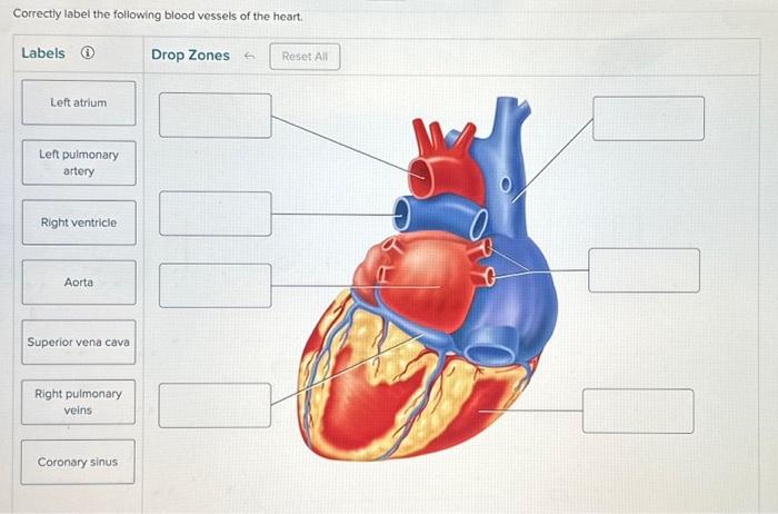 Solved Correctly label the following blood vessels of the | Chegg.com