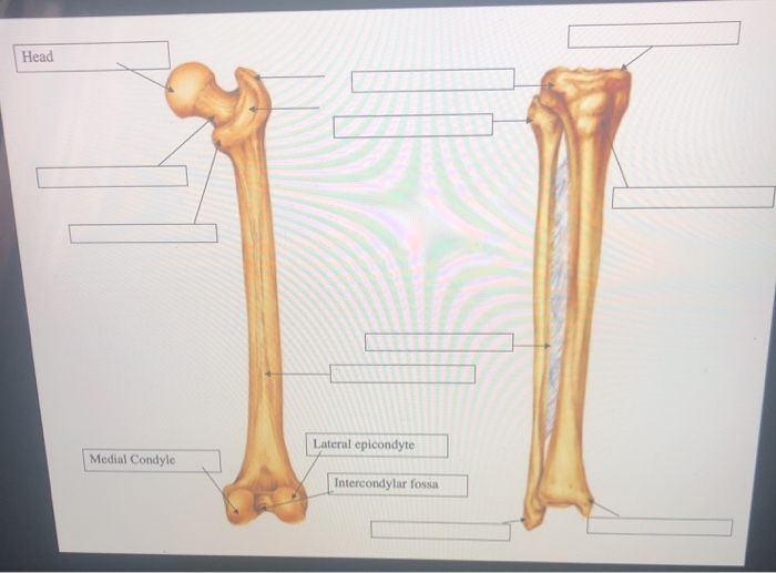 Solved Head Lateral epicondyte Medial Condyle Intercondylar | Chegg.com