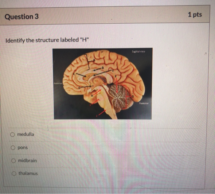 Solved Question 1 1 pts Identify the structure labeled "D" | Chegg.com