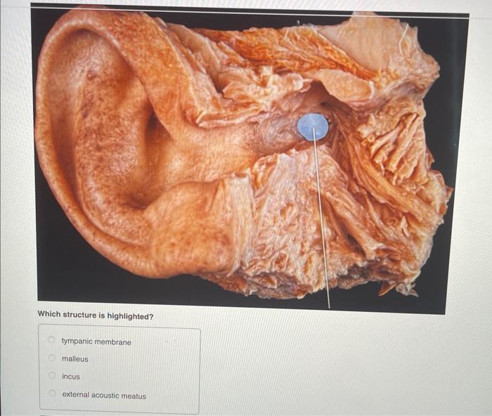 Which structure is highlighted?
tympanic membrane
malleus
incus
external acoustic meatus