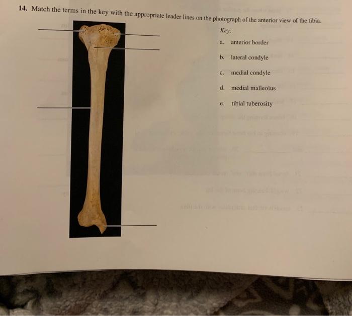 Solved neet 9 17. Match the terms in the key with the | Chegg.com