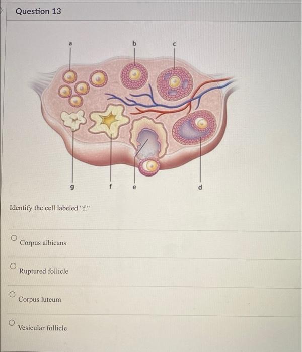 Identify the cell labeled f.
Corpus albicans
Ruptured follicle
Corpus luteum
Vesicular follicle