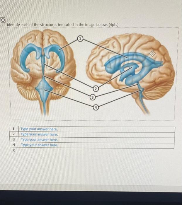 Solved Identify each of the structures/region indicated in | Chegg.com