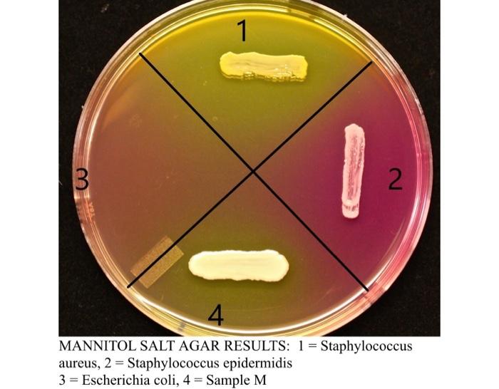 Solved An Outbreak of Food-borne Illness In early summer, a | Chegg.com