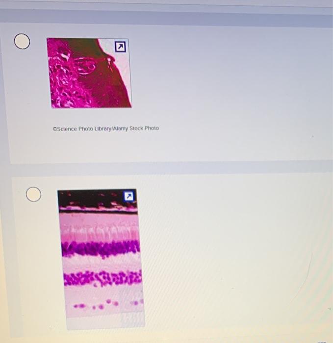 Solved Which Micrograph includes the Receptors For Hearing?
