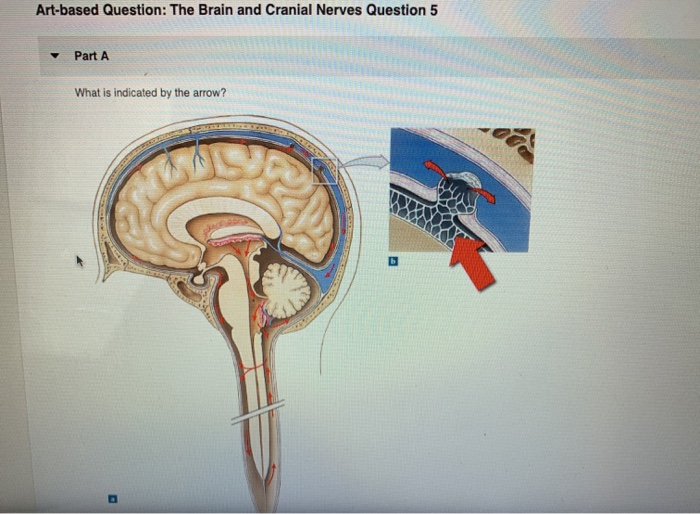 Artbased Question The Brain and Cranial Nerves