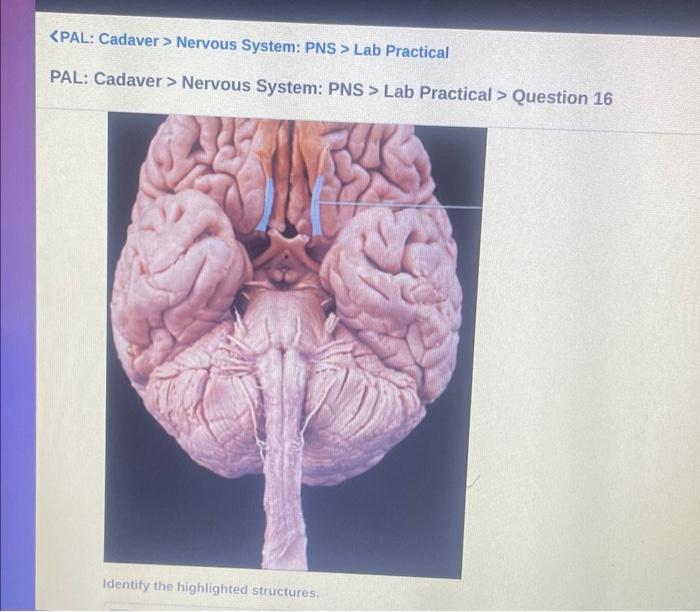 Solved PAL: Cadaver > Nervous System: PNS > Lab Practical > | Chegg.com