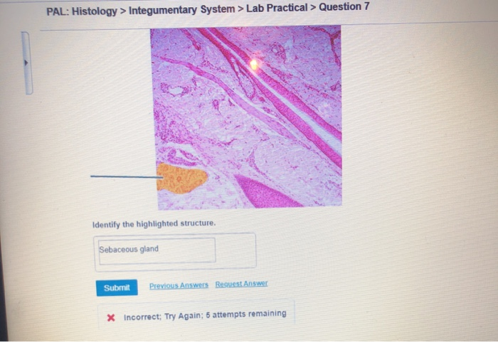 Solved Pal Histology Integumentary System Lab Practical 6794