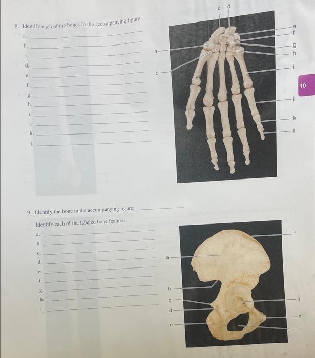 Solved 8. Identify each of the bones in the accompanying | Chegg.com