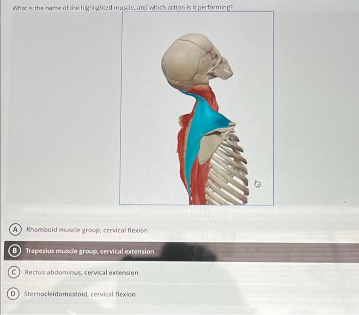 Solved What is the name of the highlighted muscle, and which | Chegg.com