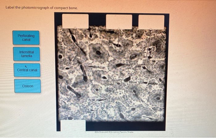 Solved Label The Photomicrograph Of Compact Bone Chegg Com