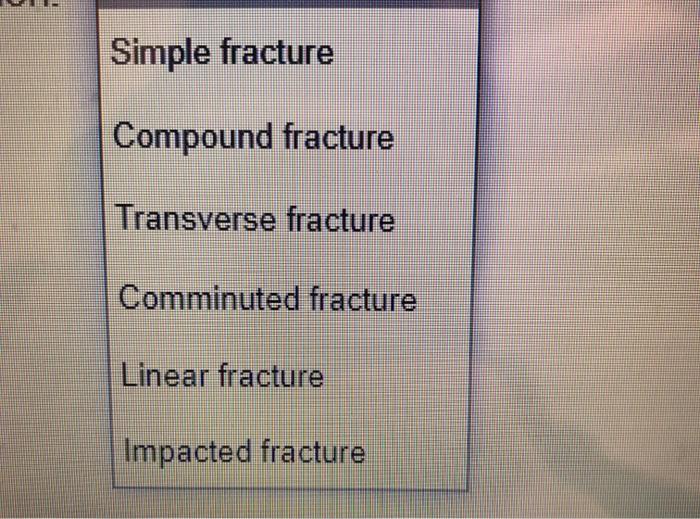 Solved Indicate the kind of fracture that matches the