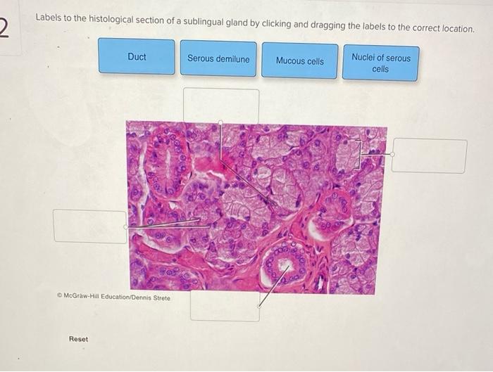 Solved Label the structures of the upper respiratory tract | Chegg.com