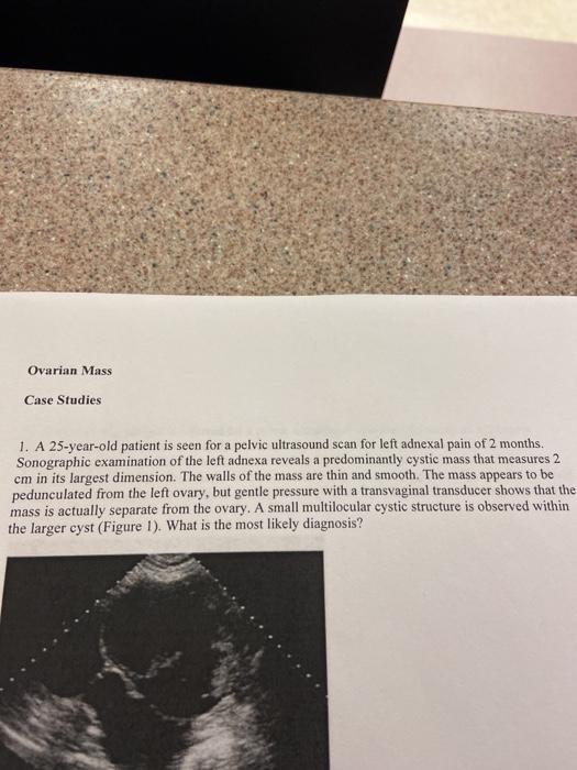 Ovarian Mass Case Studies 1. A 25-year-old patient is seen for a pelvic ultrasound scan for left adnexal pain of 2 months. So
