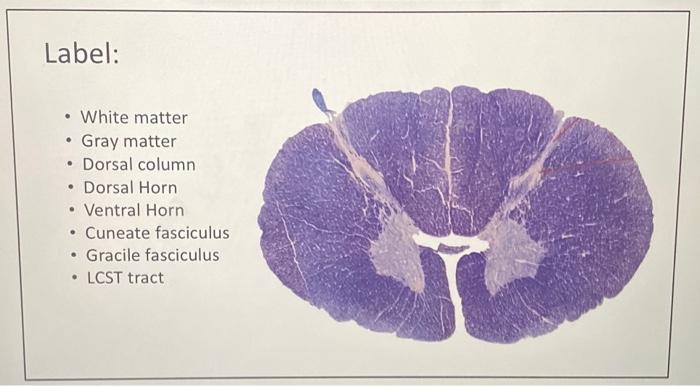 Solved - White matter - Gray matter - Dorsal column - Dorsal | Chegg.com