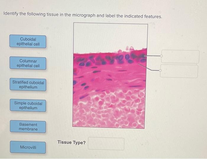 Solved Identify the following tissue in the micrograph and | Chegg.com