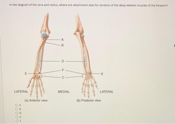 Solved In the diagram of the ulna and radius, where are | Chegg.com