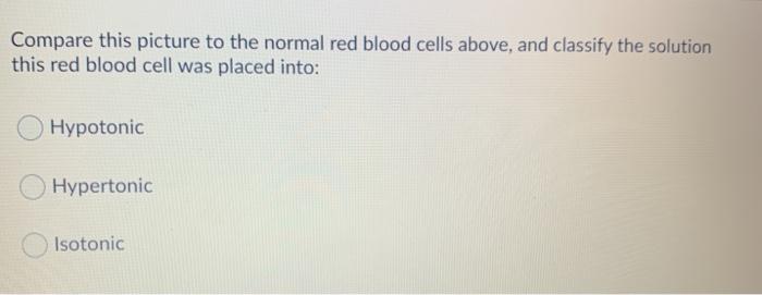 Solved This photo is of red blood cells that have been | Chegg.com