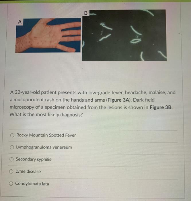 Solved Figure 1 А B A 35-year-old patient presents to the | Chegg.com