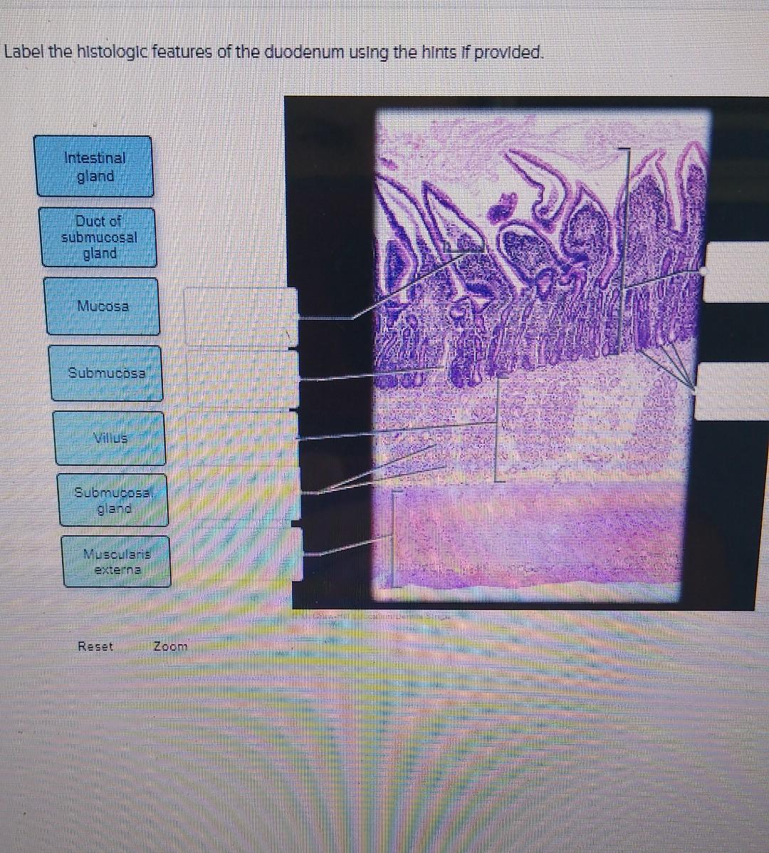 Solved Label the varlous abdominal structures using the | Chegg.com