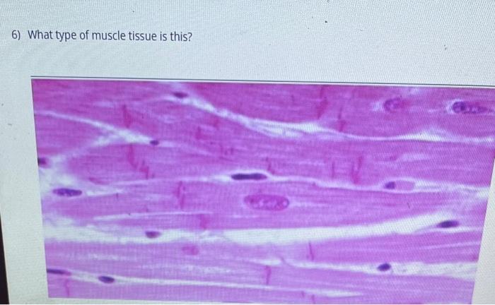 Solved 6) What type of muscle tissue is this? | Chegg.com