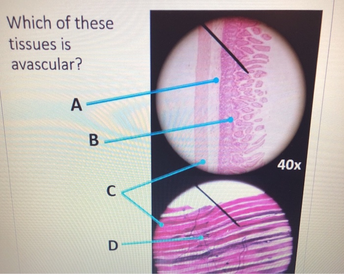 Solved Which of these tissues is avascular? A B 40x C D