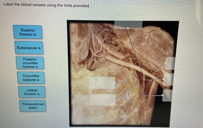 Solved Label the blood vessels using the hints provided. | Chegg.com