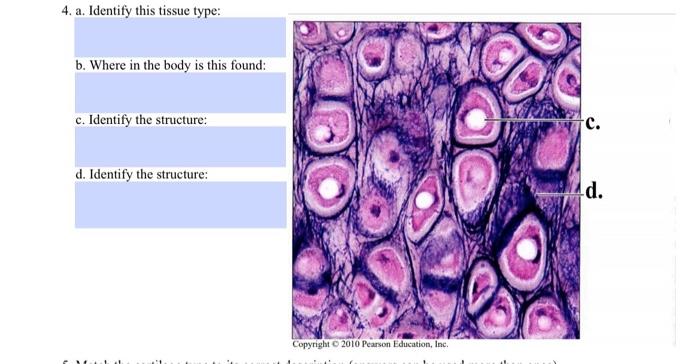 Solved 4. A. Identify This Tissue Type: B. Where In The Body | Chegg.com