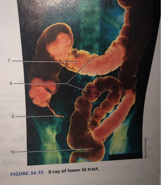 Solved Identify the structures numbered 710 on the xray of