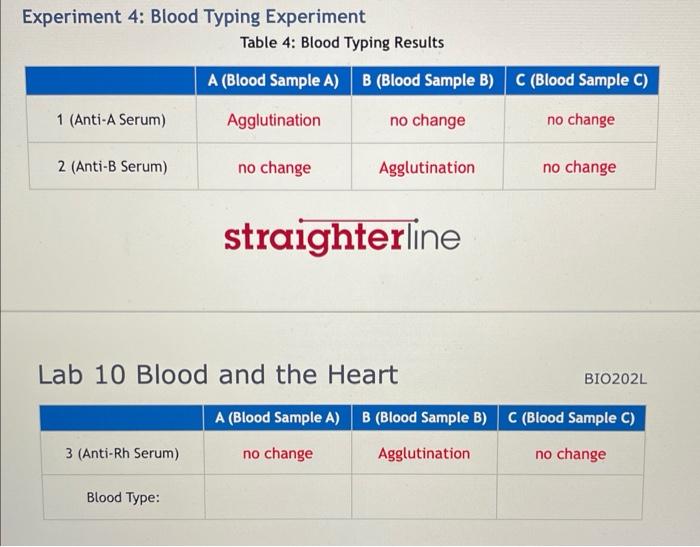 experiment 4 blood typing