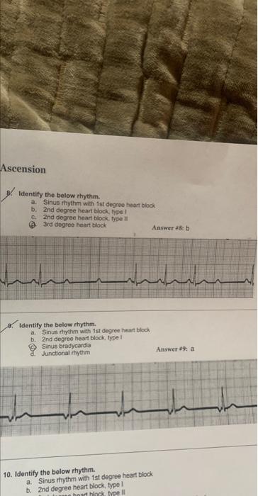 8. Identify the below rhythm. a. Sinus thythm with | Chegg.com