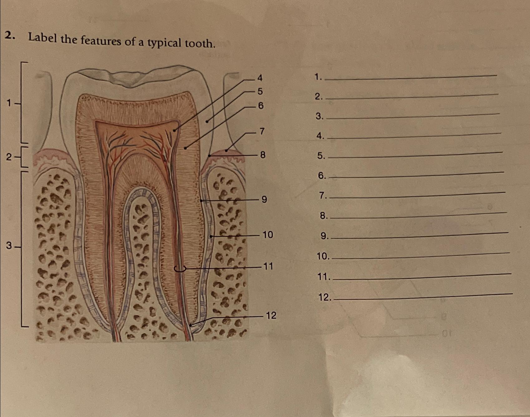 Solved Label the features of a typical tooth Biology Diagrams