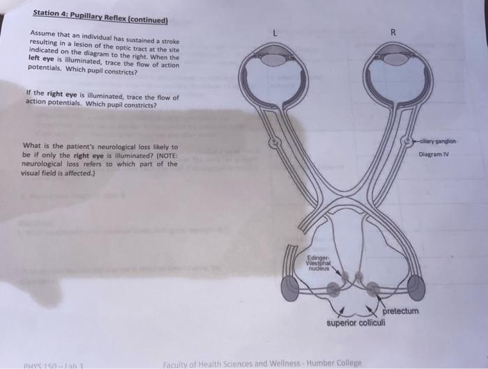 Solved Assume that an individual has sustained a stroke. | Chegg.com