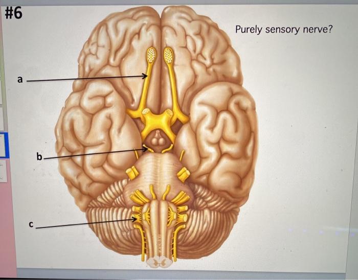 Solved #1 a) Name the elevated ridges b) Name the lobe a b | Chegg.com