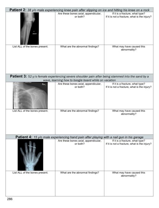 Solved Materials Patient Xray Charts (14) Normal Xray