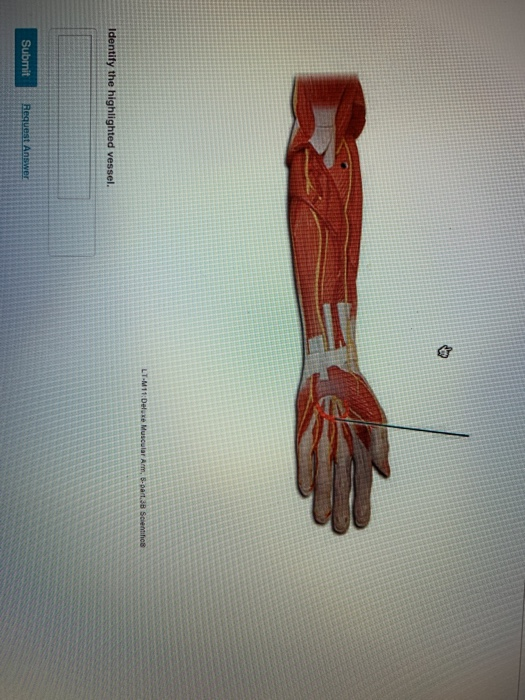 Solved LT-M11 Deluxe Muscular Arm, 5.part. Scientifico | Chegg.com