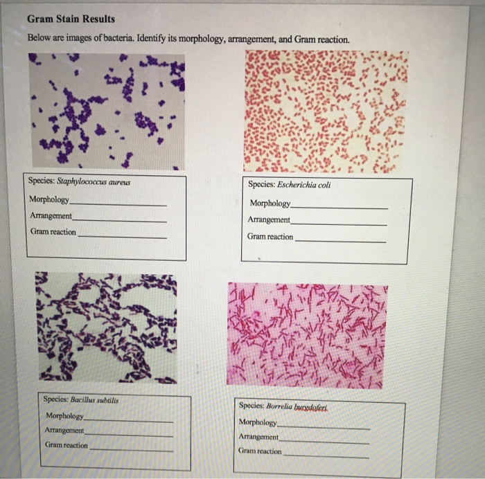 Solved Gram Stain Results Below Are Images Of Bacteria I Chegg Com