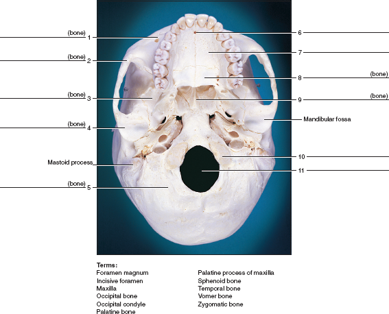 Solved: Identify the numbered bones and features of the skulls ind ...