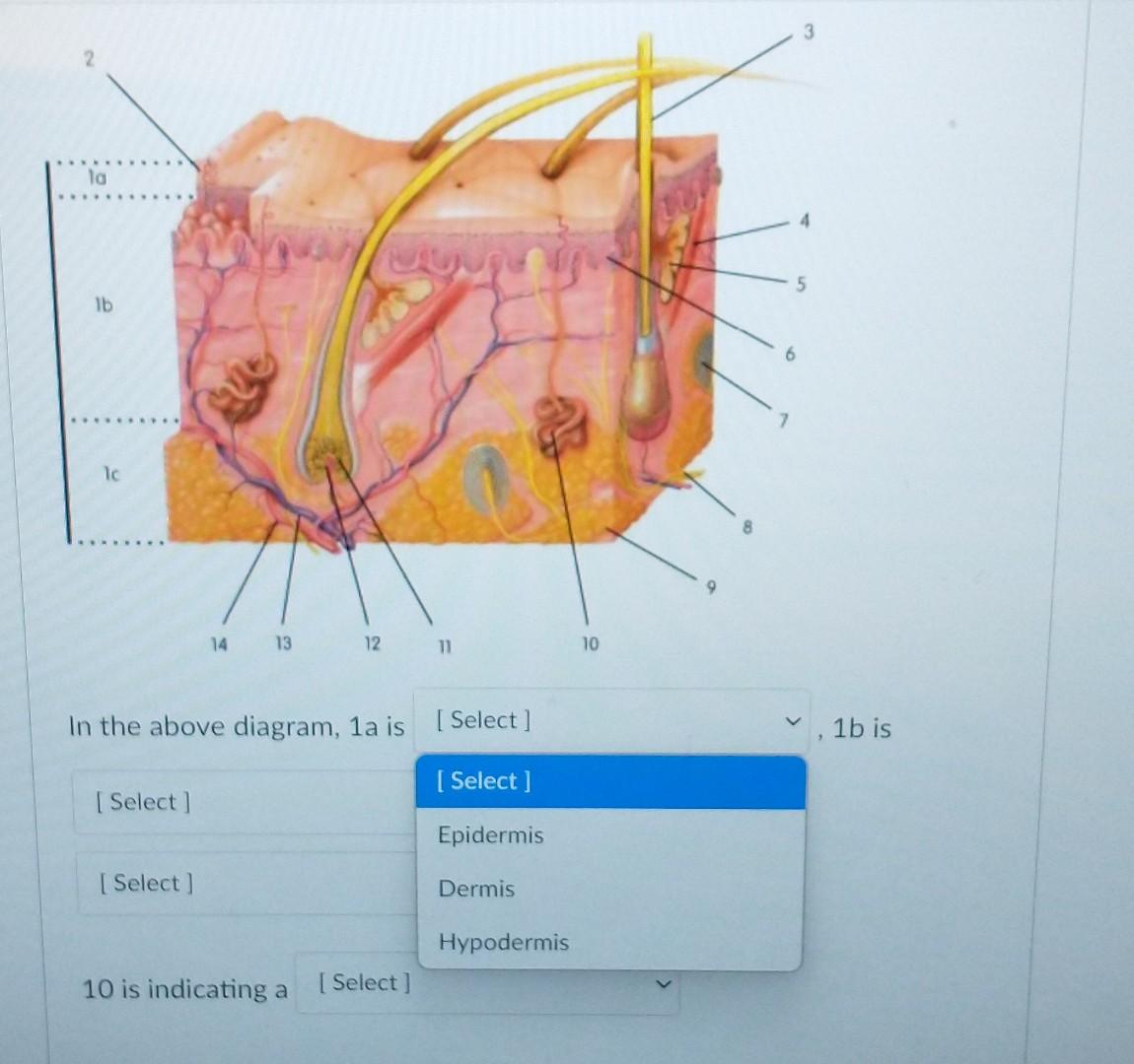 Solved Identify The Connective Tissue Pictured Below | Chegg.com