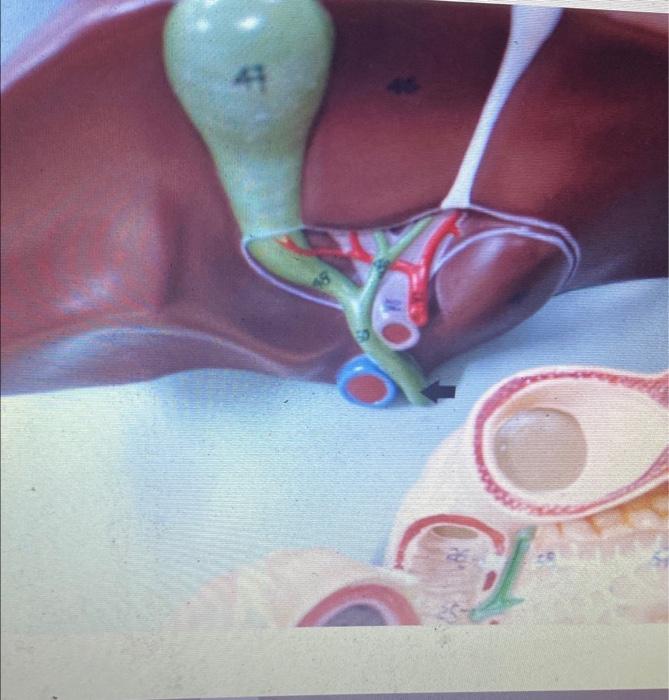 Solved Question 1 Brush border enzymes digest 1 Point carbs