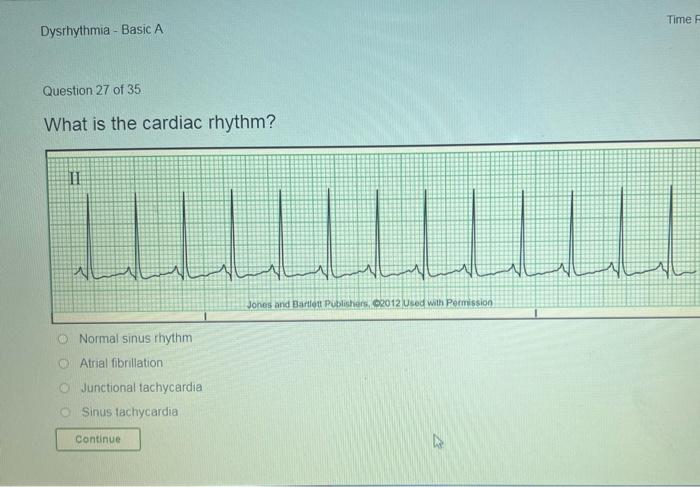 What is the cardiac rhythm?
Normal sinus rhythm
Atrial fibrillation
Junctional tachycardia