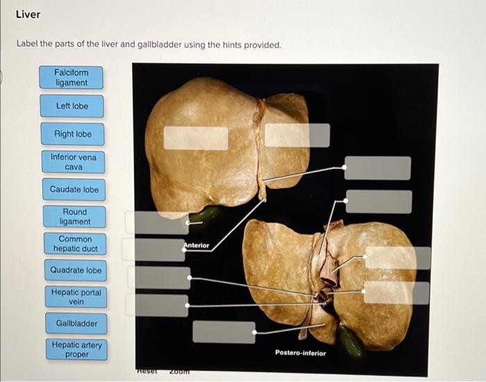 Solved Liver Label the parts of the liver and gallbladder