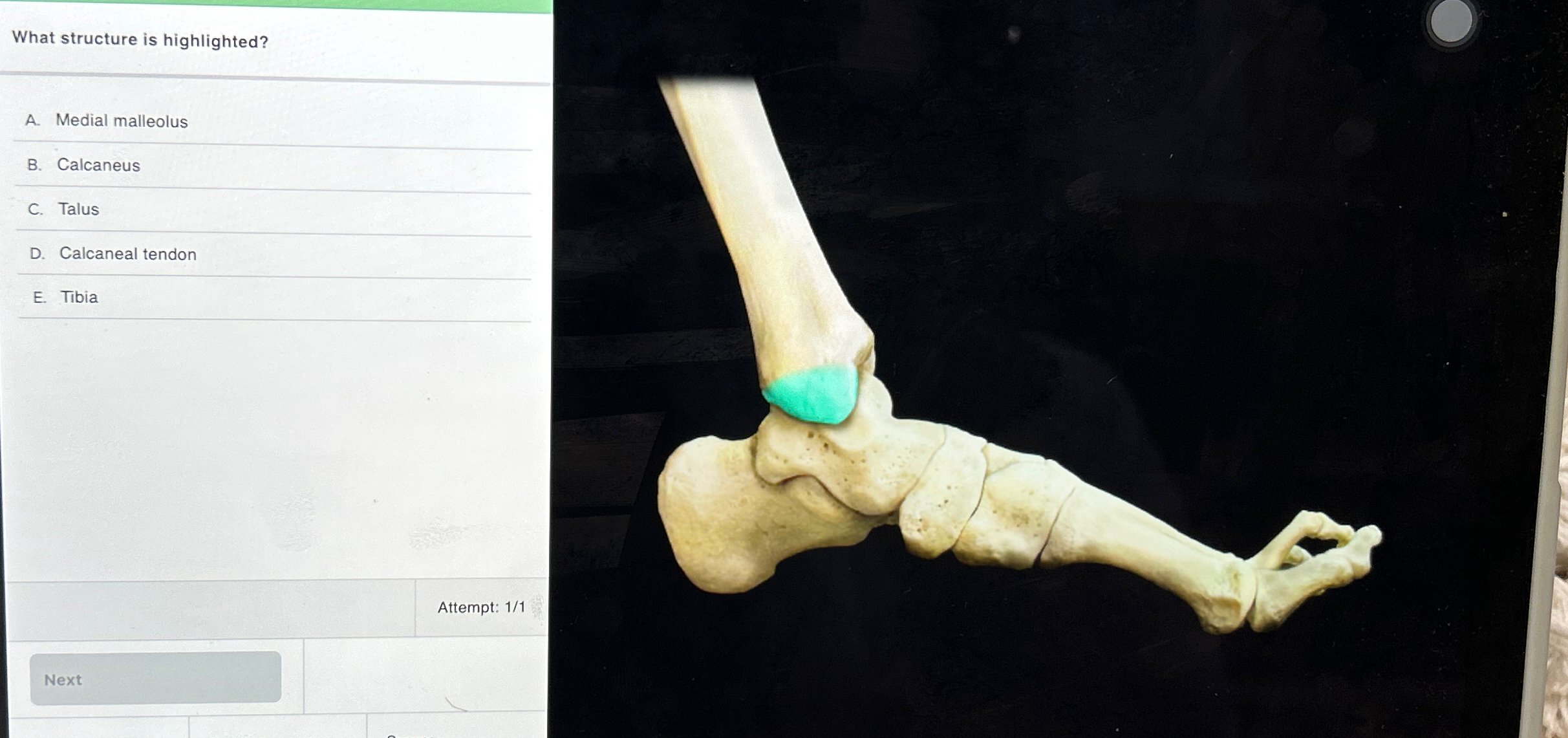 Solved What structure is highlighted?A. ﻿Medial malleolusB. | Chegg.com