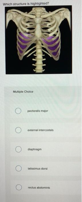 Solved Which structure is highlighted? Multiple Choice O O | Chegg.com