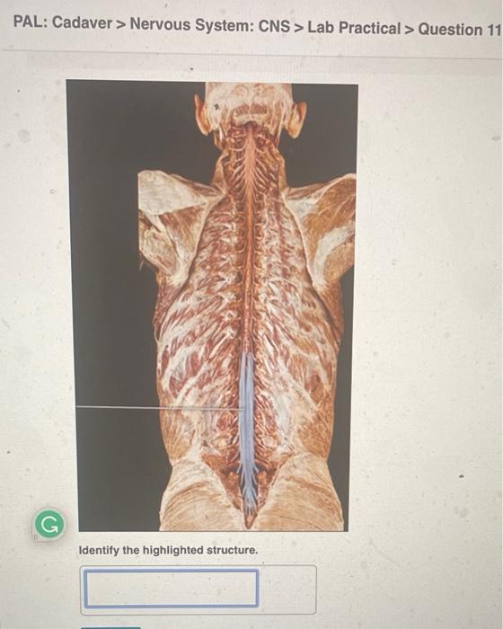 PAL: Cadaver > Nervous System: CNS> Lab Practical > Question 11
Identify the highlighted structure.
40